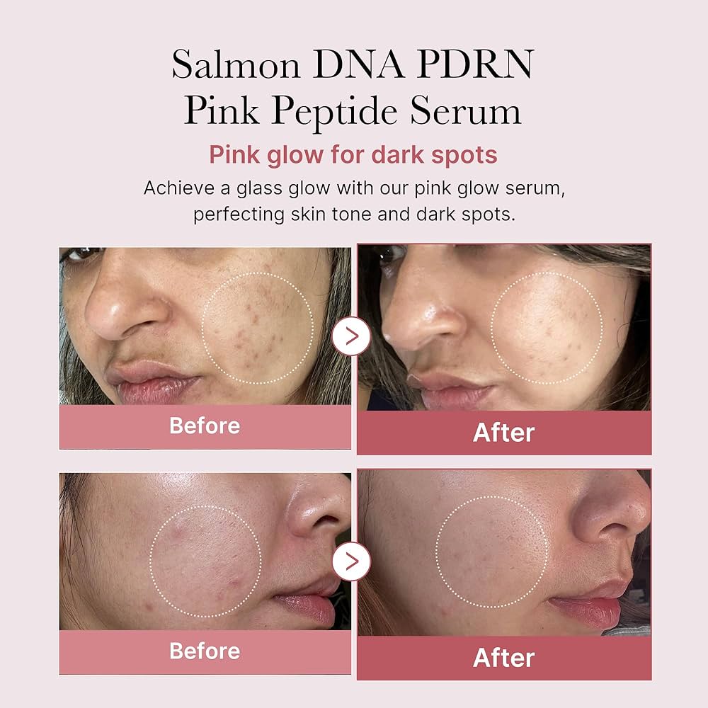 Salmon PDRN Serum Mask
