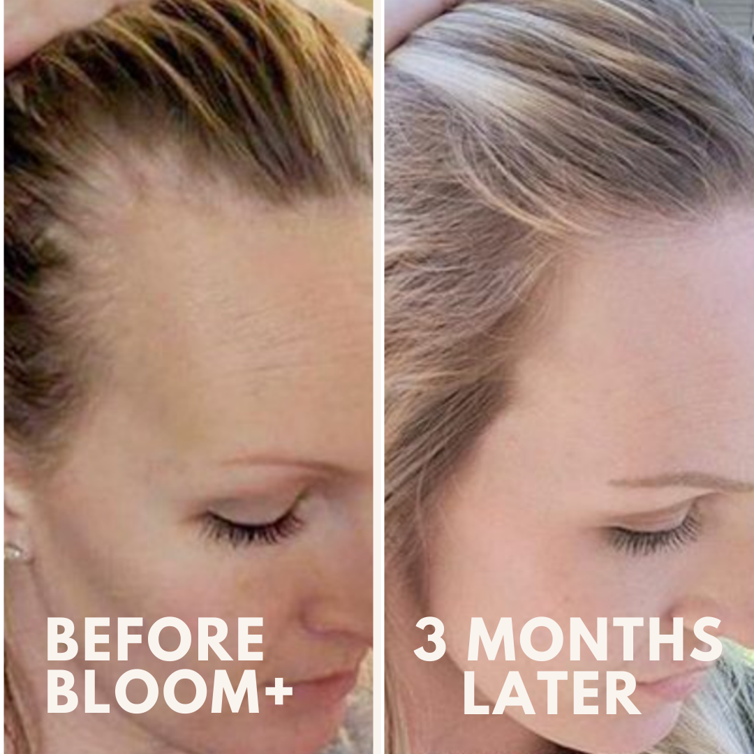 BLOOM+ Hair Growth Revival Serum