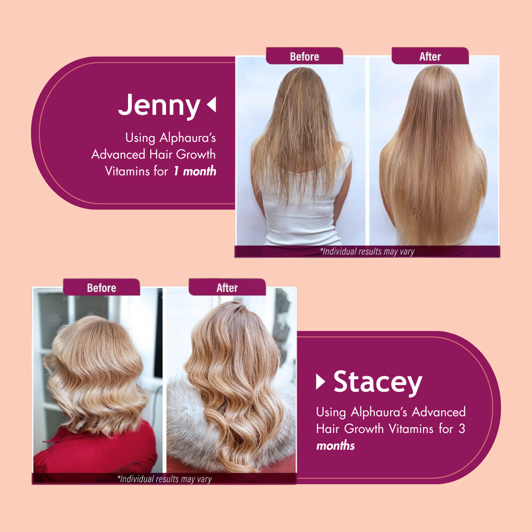 24-in-1 Advanced Hair Growth Vitamins - Biotin 10,000 mcg + Collagen & MSM, Supports Thicker, Healthier Hair